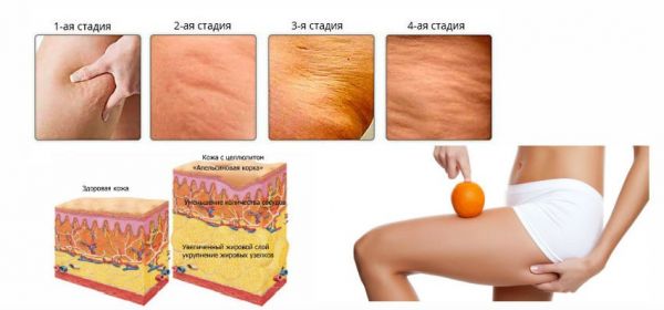 OUHOE Anti-cellulite gel scrub for weight loss